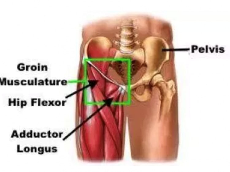 Fixing Hip Flexor Pain
